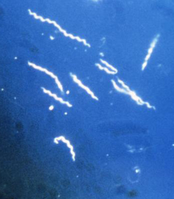 Image:Borrelia burgdorferi-cropped.jpg