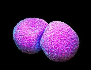 Streptococcus pneumoniae 