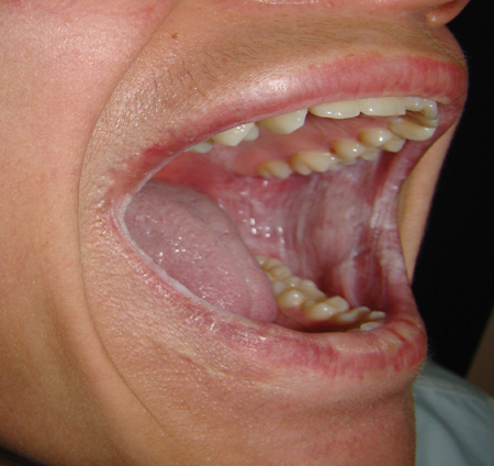 Image:1510rdhcbur02.png