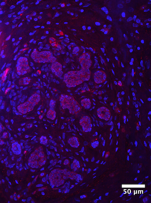 Image:B1 tissue.png