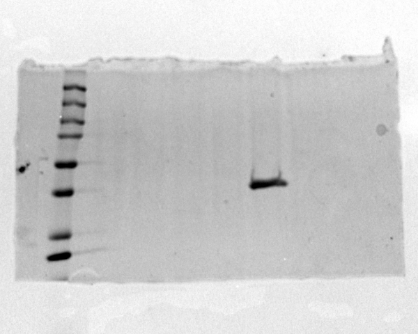 Image:ProteinGel.jpg