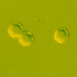 Image:Acanthamoeba_cysts_culture_Vish1.jpg