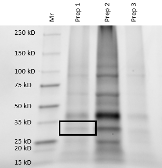 Image:FINAL gel.png