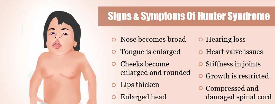 Image:Signs-and-symptoms-of-hunter-syndrome.jpg