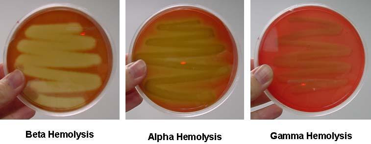 Image:Hemolysis3-147A9D970590BADE656.jpg