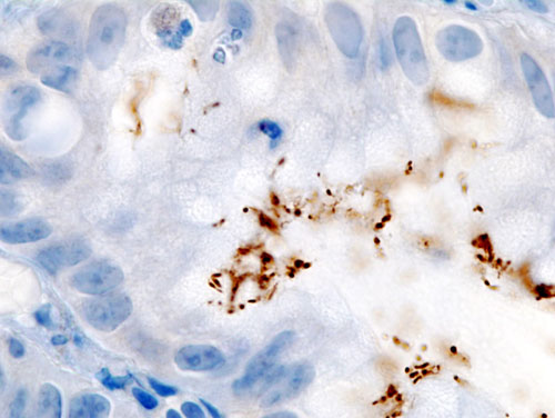 Image:Ihc hrp.jpg