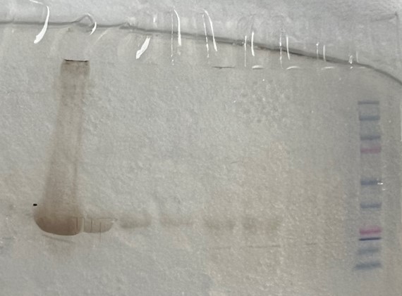 Image:Gel_2.jpg