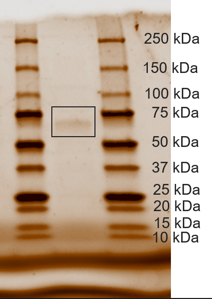 Image:SDSPAGEFigure.png