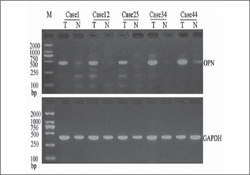 Image:GAPDH western blot.jpg