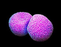 Streptococcus pneumoniae 