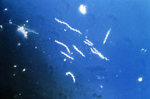 Borrelia Burgdorferi