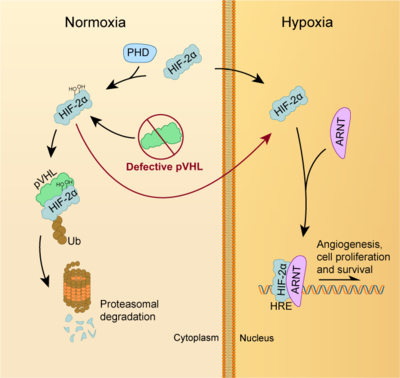HIF-2α pathway in ccRCC