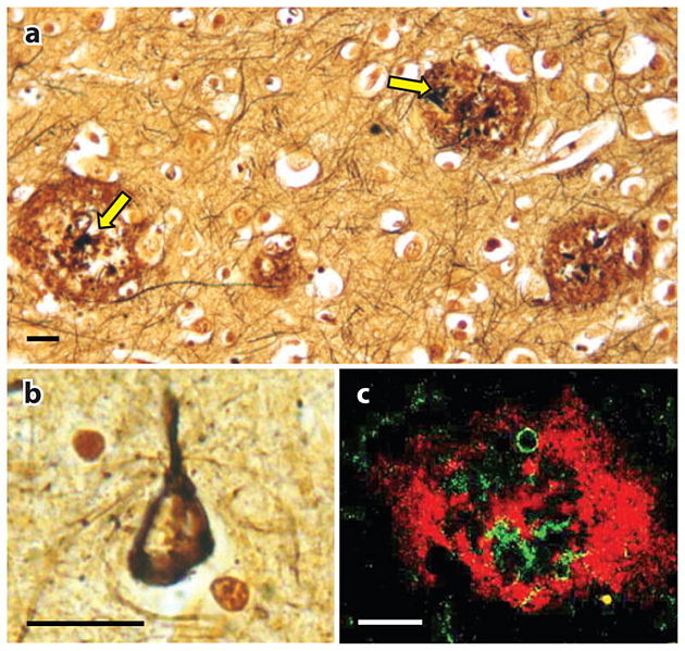 Image:Nihms319849f1.jpg