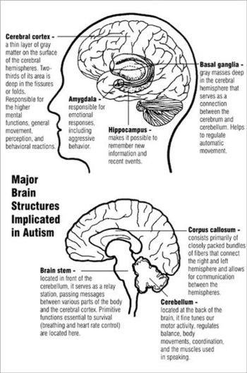Description of an Autistic Brain
