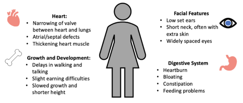 Figure 4. Common Symptoms of Noonan Syndrome. 
