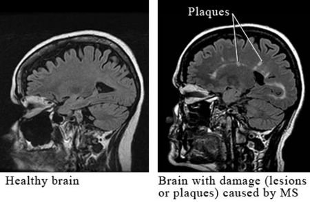 Courtesy of Intermountain Medical Imaging, Boise, Idaho.