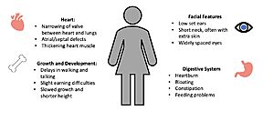 Figure 4. Common Symptoms of Noonan Syndrome. 