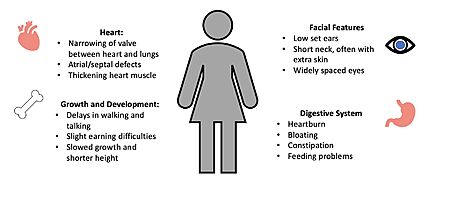 Figure 4. Common Symptoms of Noonan Syndrome. 
