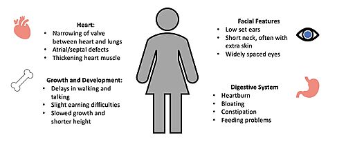 Figure 4. Common Symptoms of Noonan Syndrome. 