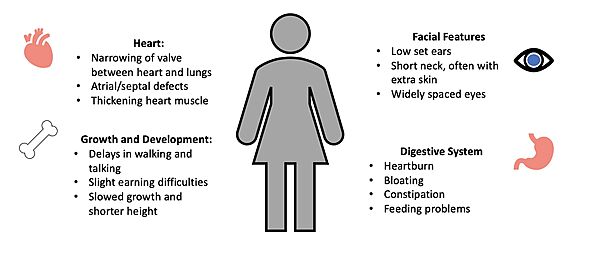 Figure 4. Common Symptoms of Noonan Syndrome. 