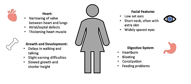 Image:Noonan syndrome figure.jpg