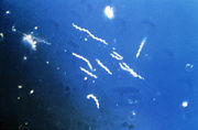 Using darkfield microscopy technique, this photomicrograph, magnified 400x, reveals the presence of spirochaete, or "corkscrew-shaped" bacteria known as Borrelia burgdorferi