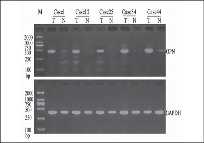 Image:GAPDH western blot.jpg