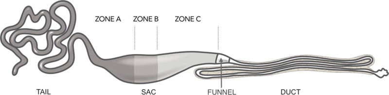 Image:Major ampullate gland.jpeg
